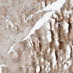 VAMP5 Antibody in Immunohistochemistry (Paraffin) (IHC (P))