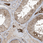 ZNF263 Antibody in Immunohistochemistry (Paraffin) (IHC (P))