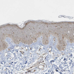 ZNF263 Antibody in Immunohistochemistry (Paraffin) (IHC (P))