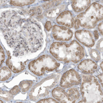 ZNF263 Antibody in Immunohistochemistry (Paraffin) (IHC (P))
