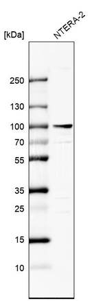 ZNF263 Antibody in Western Blot (WB)
