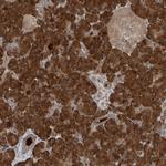 KIAA0556 Polyclonal Antibody