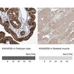 KIAA0556 Antibody in Immunohistochemistry (IHC)