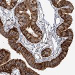 KIAA0556 Antibody in Immunohistochemistry (IHC)