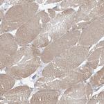 KIAA0556 Antibody in Immunohistochemistry (IHC)