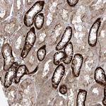 LRRC74A Polyclonal Antibody