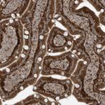 GOLGA4 Antibody in Immunohistochemistry (Paraffin) (IHC (P))