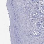 CRYGS Polyclonal Antibody