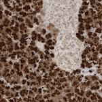C21orf58 Antibody in Immunohistochemistry (Paraffin) (IHC (P))
