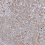 C21orf58 Antibody in Immunohistochemistry (Paraffin) (IHC (P))