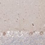 GKAP1 Antibody in Immunohistochemistry (Paraffin) (IHC (P))