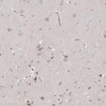 GKAP1 Antibody in Immunohistochemistry (Paraffin) (IHC (P))
