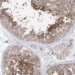 GKAP1 Polyclonal Antibody