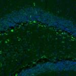 GKAP1 Antibody in Immunohistochemistry (Paraffin) (IHC (P))