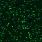GKAP1 Antibody in Immunohistochemistry (Paraffin) (IHC (P))