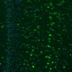 GKAP1 Antibody in Immunohistochemistry (Paraffin) (IHC (P))