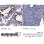 GKAP1 Antibody in Immunohistochemistry (IHC)