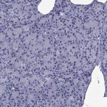 GKAP1 Antibody in Immunohistochemistry (IHC)