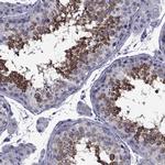 GKAP1 Antibody in Immunohistochemistry (IHC)