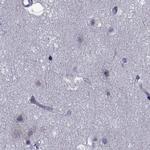 GKAP1 Antibody in Immunohistochemistry (IHC)