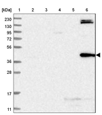 TRMT2B Antibody in Western Blot (WB)