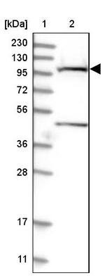 SLC9A2 Antibody in Western Blot (WB)