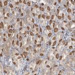 TBC1D5 Polyclonal Antibody