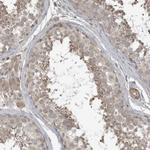 PRRT3 Antibody in Immunohistochemistry (Paraffin) (IHC (P))