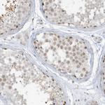 PRRT3 Polyclonal Antibody