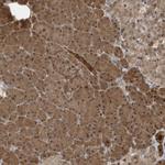 CATSPERB Polyclonal Antibody