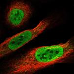 FAM9B Polyclonal Antibody