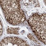 FAM9B Antibody in Immunohistochemistry (Paraffin) (IHC (P))