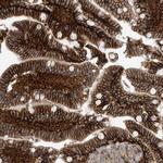 FSD1L Polyclonal Antibody