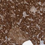 RPL34 Antibody in Immunohistochemistry (Paraffin) (IHC (P))