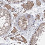 RPL34 Antibody in Immunohistochemistry (Paraffin) (IHC (P))