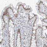 ZNF787 Antibody in Immunohistochemistry (Paraffin) (IHC (P))