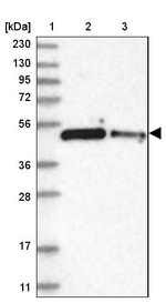 ZNF787 Antibody in Western Blot (WB)