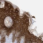 RABL3 Antibody in Immunohistochemistry (Paraffin) (IHC (P))