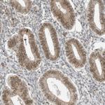 RABL3 Antibody in Immunohistochemistry (Paraffin) (IHC (P))