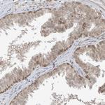RABL3 Antibody in Immunohistochemistry (Paraffin) (IHC (P))