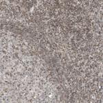 RABL3 Antibody in Immunohistochemistry (Paraffin) (IHC (P))