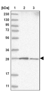 RABL3 Antibody in Western Blot (WB)