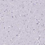 MOBP Antibody in Immunohistochemistry (Paraffin) (IHC (P))