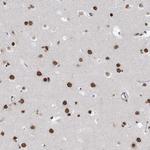 ZNF792 Antibody in Immunohistochemistry (Paraffin) (IHC (P))