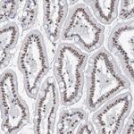 ZNF792 Polyclonal Antibody