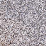 ZNF792 Antibody in Immunohistochemistry (Paraffin) (IHC (P))