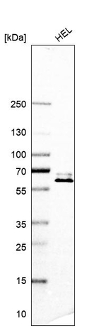 ZNF792 Antibody in Western Blot (WB)