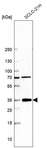 ZFAND2B Antibody in Western Blot (WB)