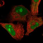 ZFAND2B Antibody in Immunocytochemistry (ICC/IF)
