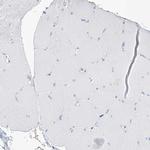 SGOL2 Antibody in Immunohistochemistry (Paraffin) (IHC (P))
